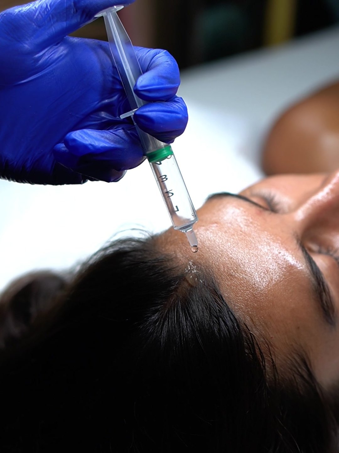 Exosome serum being applied to a client's scalp at Waldor Clinic, 35 Great Portland Street