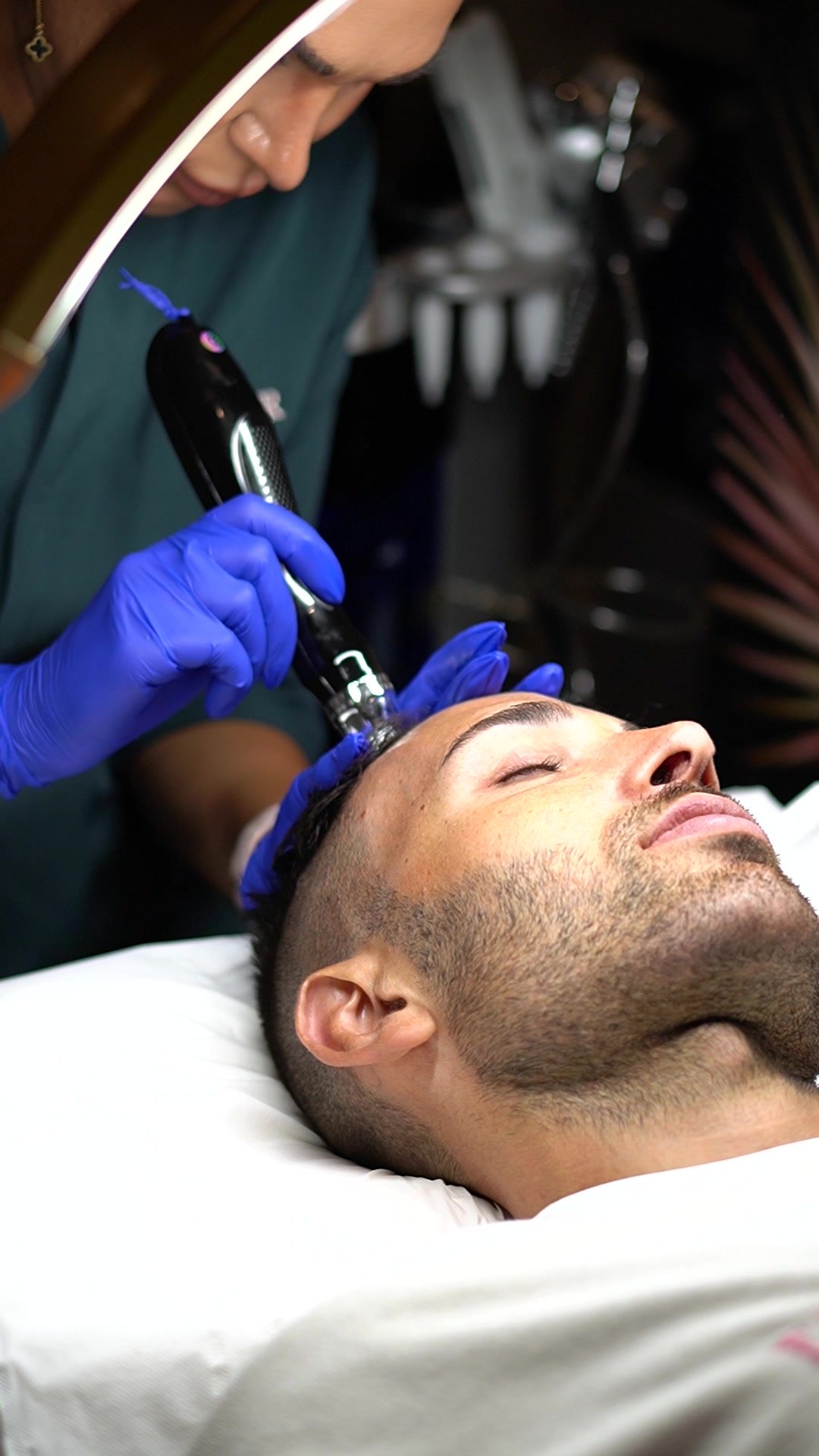 Close up of a Waldor Clinic hair and scalp restoration specialist using a microneedling pen along a client's hairline